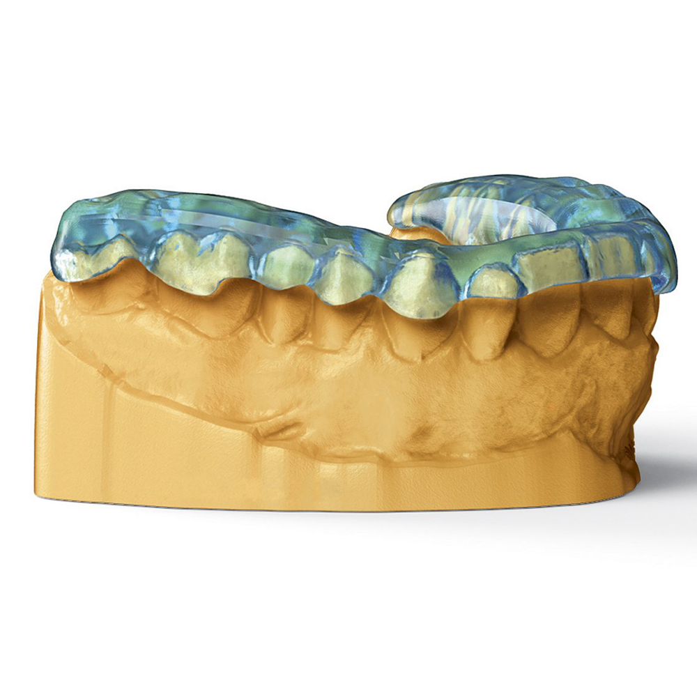 NextDent Ortho Rigid - Transparent Blue | Ultimate 3D Printing Store