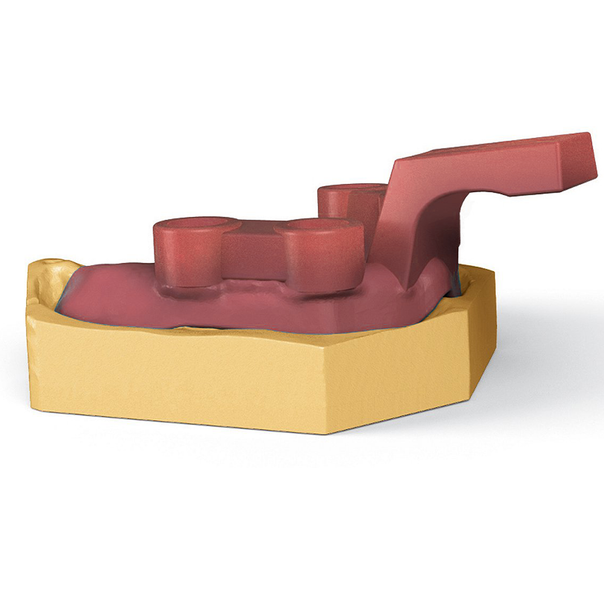 NextDent Tray Resin - Pink - Ultimate 3D Printing Store