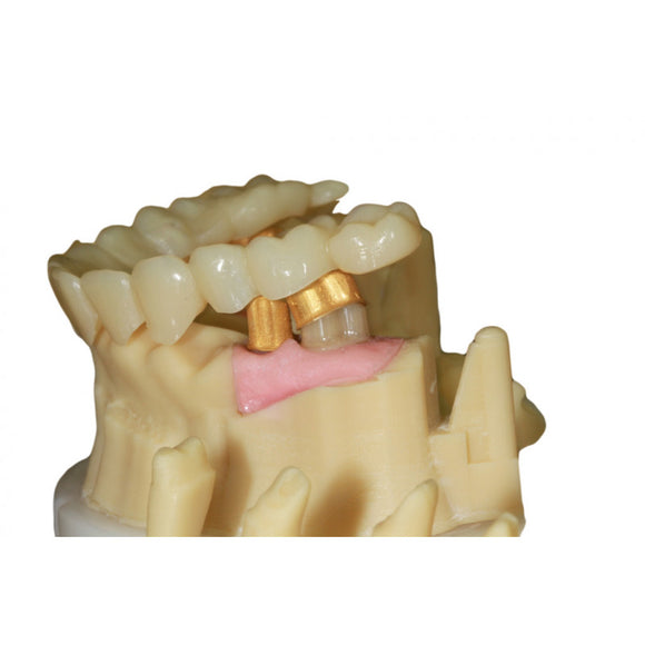 DruckWege - Type D Dental Model Plus